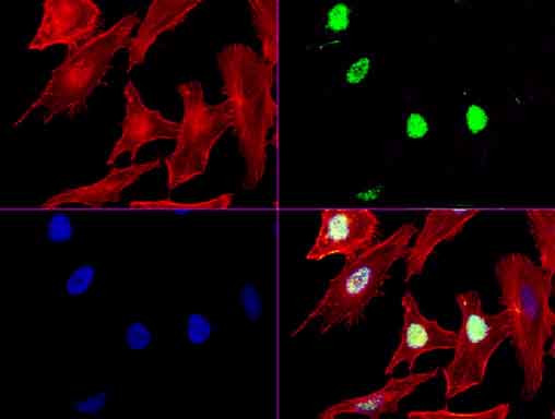 XRCC1 Antibody in Immunocytochemistry (ICC/IF)