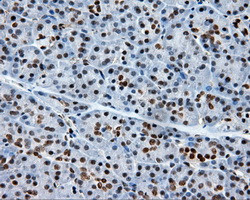 XRCC1 Antibody in Immunohistochemistry (Paraffin) (IHC (P))