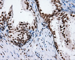 XRCC1 Antibody in Immunohistochemistry (Paraffin) (IHC (P))