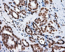 XRCC1 Antibody in Immunohistochemistry (Paraffin) (IHC (P))