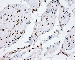 XRCC1 Antibody in Immunohistochemistry (Paraffin) (IHC (P))