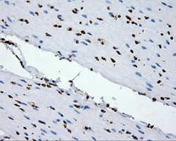 XRCC1 Antibody in Immunohistochemistry (Paraffin) (IHC (P))