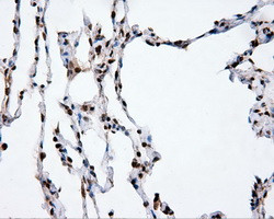 XRCC1 Antibody in Immunohistochemistry (Paraffin) (IHC (P))