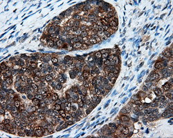 XRCC1 Antibody in Immunohistochemistry (Paraffin) (IHC (P))