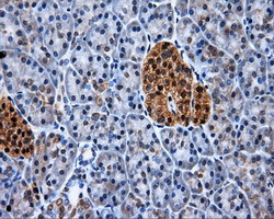 XRCC1 Antibody in Immunohistochemistry (Paraffin) (IHC (P))