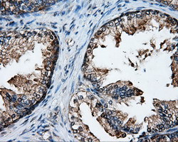 XRCC1 Antibody in Immunohistochemistry (Paraffin) (IHC (P))