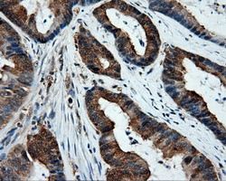 XRCC1 Antibody in Immunohistochemistry (Paraffin) (IHC (P))