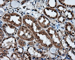 XRCC1 Antibody in Immunohistochemistry (Paraffin) (IHC (P))