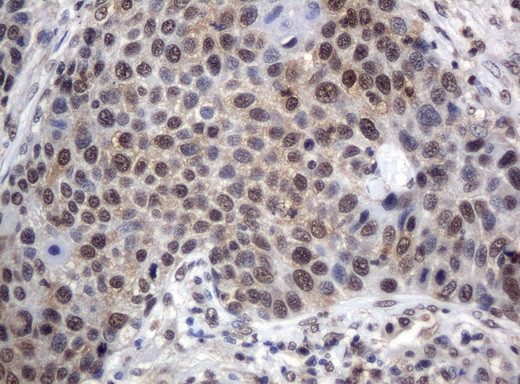 XRCC1 Antibody in Immunohistochemistry (Paraffin) (IHC (P))