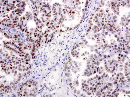 XRCC1 Antibody in Immunohistochemistry (Paraffin) (IHC (P))