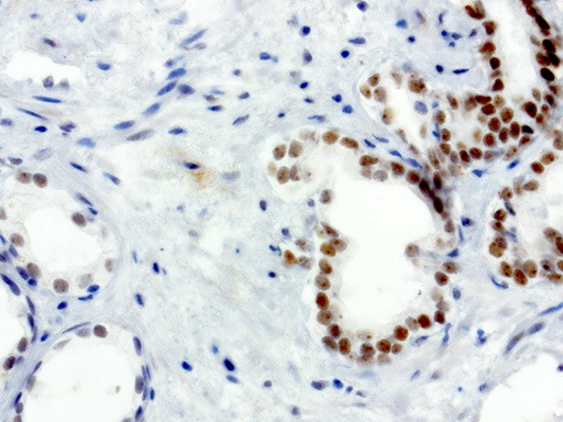 XRCC1 Antibody in Immunohistochemistry (Paraffin) (IHC (P))