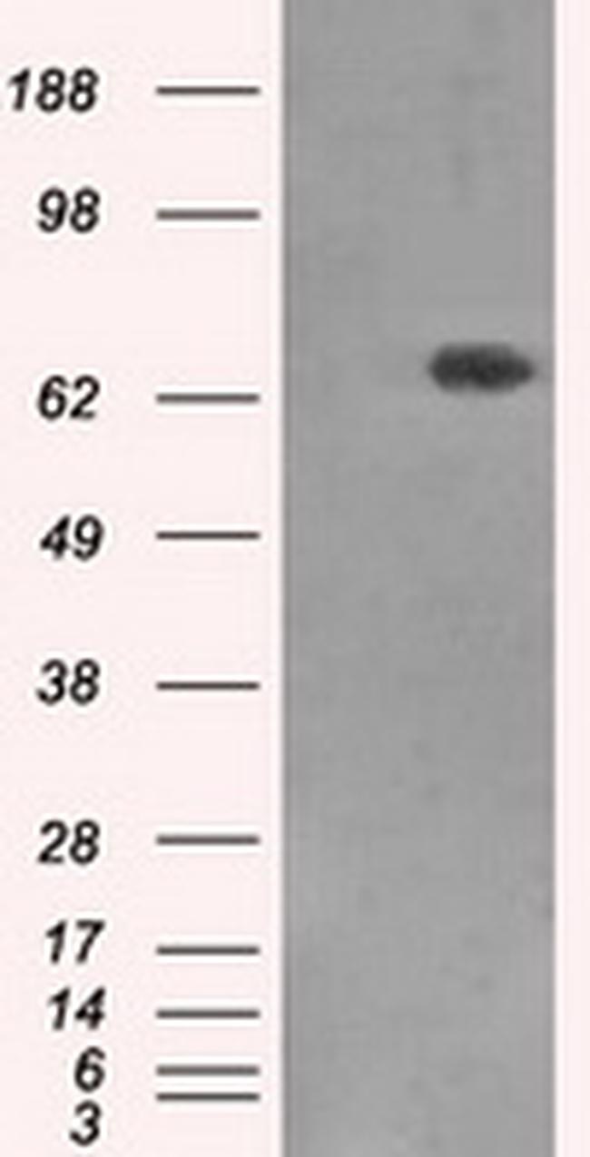 XRCC1 Antibody in Western Blot (WB)