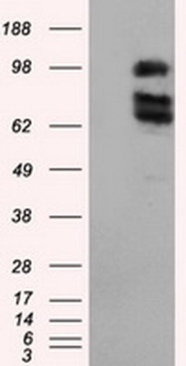 XRCC1 Antibody in Western Blot (WB)