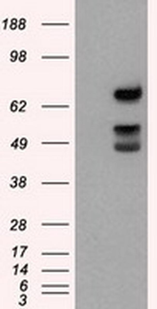 XRCC1 Antibody in Western Blot (WB)