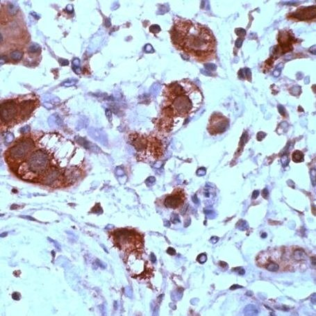 XRCC2 Antibody in Immunohistochemistry (Paraffin) (IHC (P))