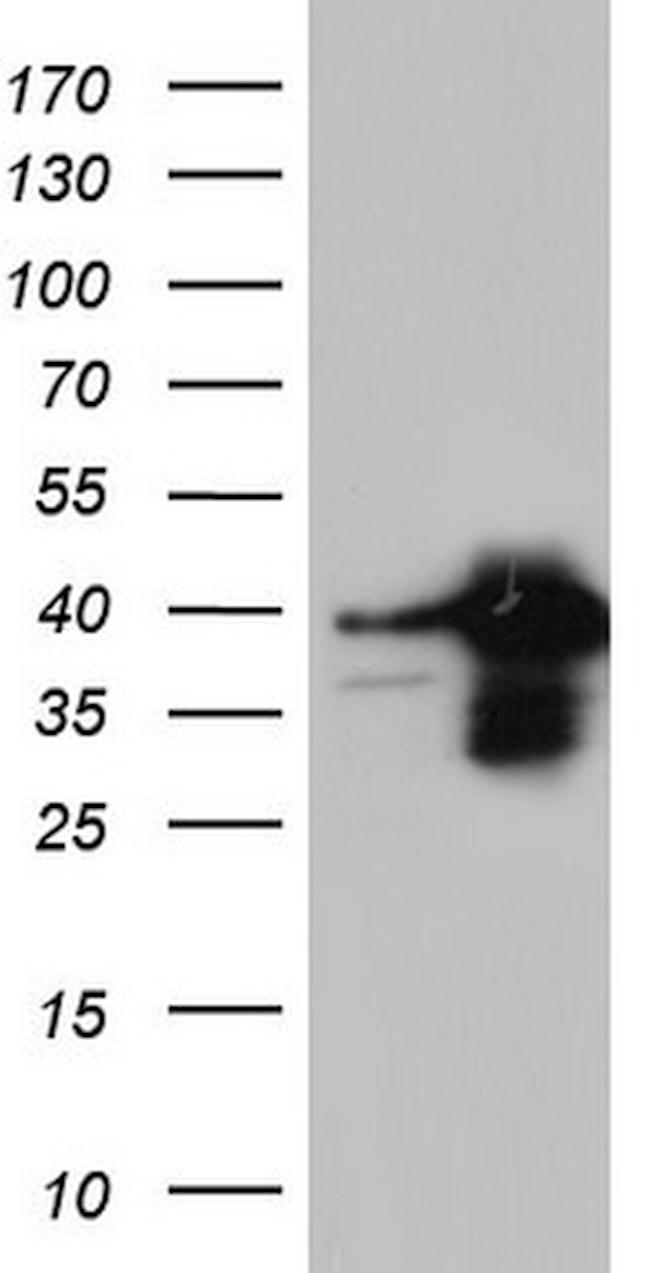 XRCC3 Antibody in Western Blot (WB)