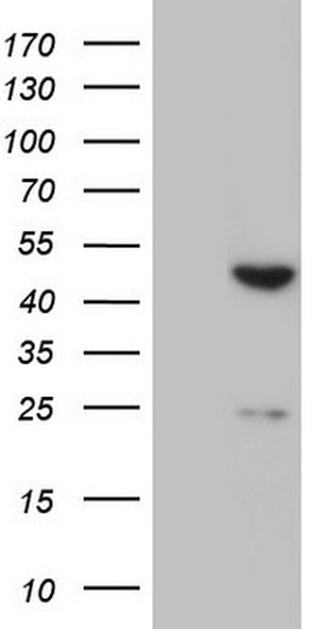 XRCC3 Antibody in Western Blot (WB)