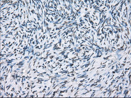 XRCC4 Antibody in Immunohistochemistry (Paraffin) (IHC (P))