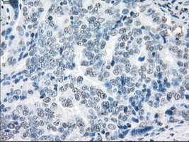 XRCC4 Antibody in Immunohistochemistry (Paraffin) (IHC (P))