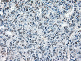 XRCC4 Antibody in Immunohistochemistry (Paraffin) (IHC (P))