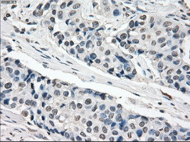 XRCC4 Antibody in Immunohistochemistry (Paraffin) (IHC (P))