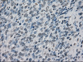 XRCC4 Antibody in Immunohistochemistry (Paraffin) (IHC (P))