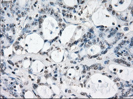 XRCC4 Antibody in Immunohistochemistry (Paraffin) (IHC (P))