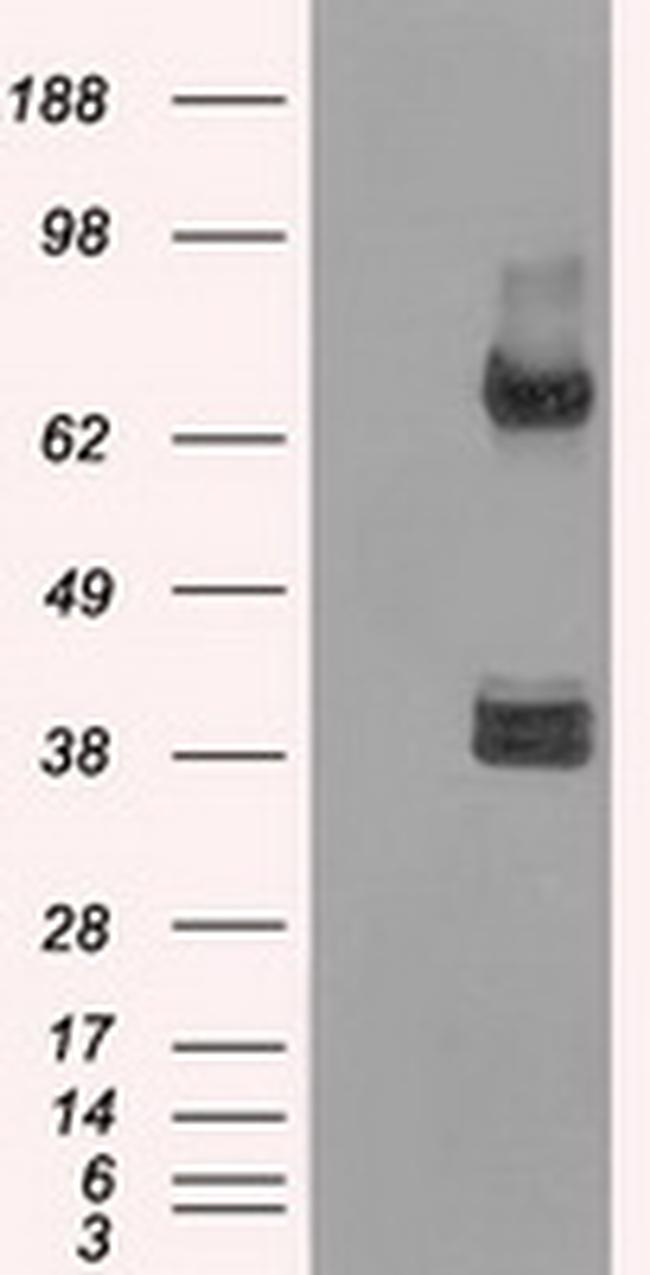 XRCC4 Antibody in Western Blot (WB)