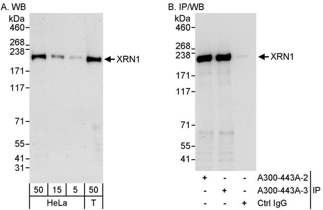 XRN1 Antibody in Western Blot (WB)