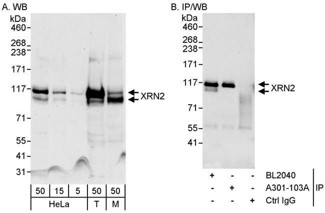 XRN2 Antibody in Western Blot (WB)