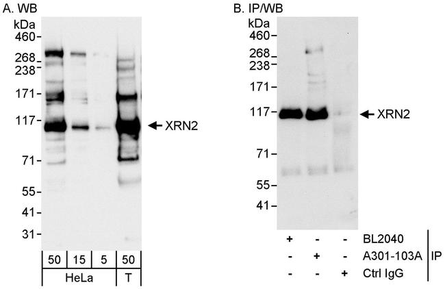 XRN2 Antibody in Western Blot (WB)