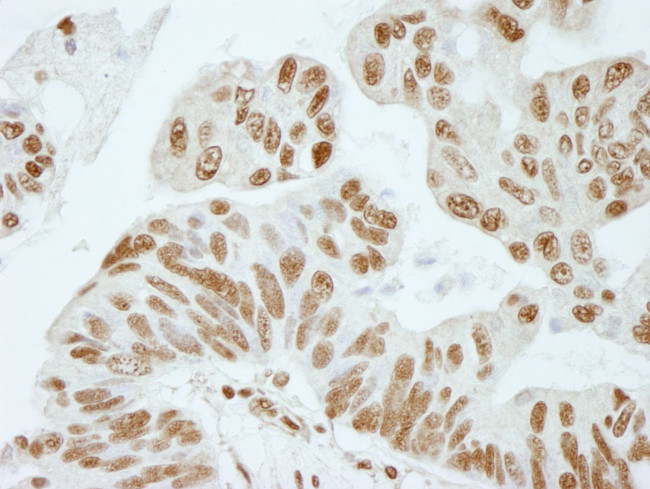 XRN2 Antibody in Immunohistochemistry (IHC)