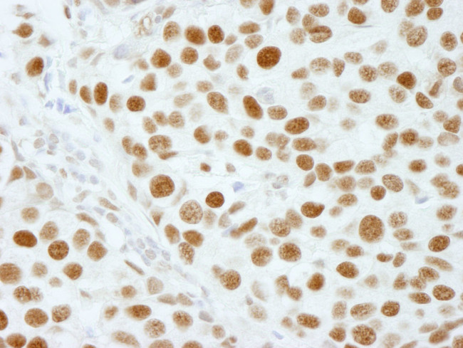 XRN2 Antibody in Immunohistochemistry (IHC)