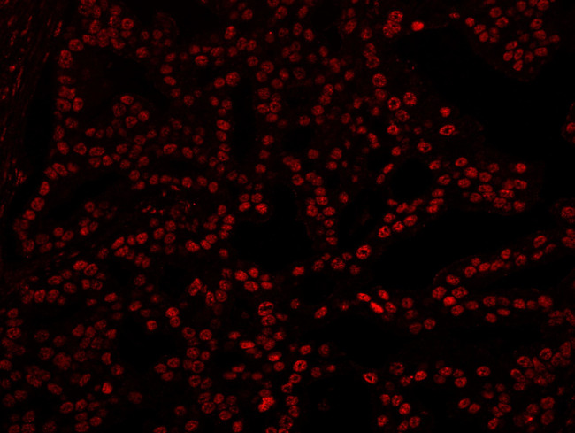 XRN2 Antibody in Immunohistochemistry (IHC)