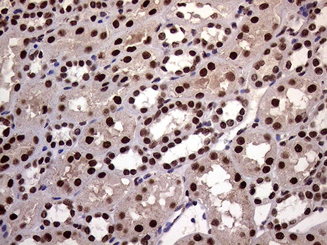 XRN2 Antibody in Immunohistochemistry (Paraffin) (IHC (P))