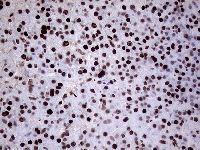 XRN2 Antibody in Immunohistochemistry (Paraffin) (IHC (P))