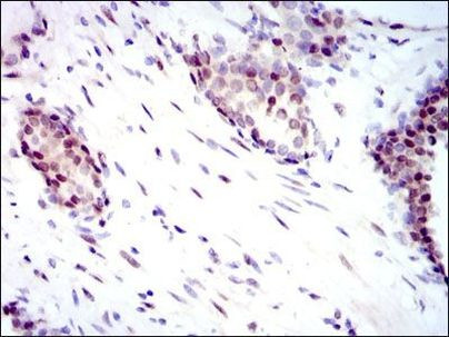 YAP1 Antibody in Immunohistochemistry (Paraffin) (IHC (P))