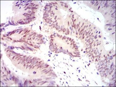 YAP1 Antibody in Immunohistochemistry (Paraffin) (IHC (P))