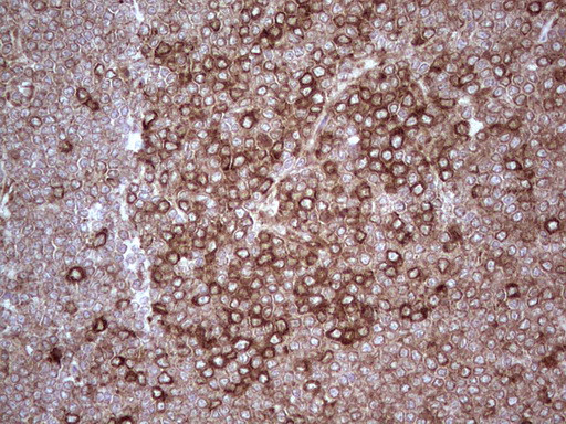 YBX1 Antibody in Immunohistochemistry (Paraffin) (IHC (P))