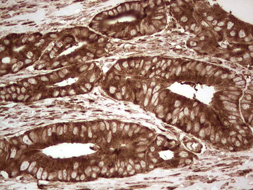 YBX1 Antibody in Immunohistochemistry (Paraffin) (IHC (P))