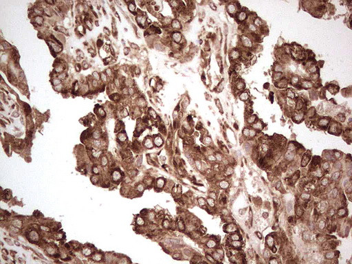 YBX1 Antibody in Immunohistochemistry (Paraffin) (IHC (P))