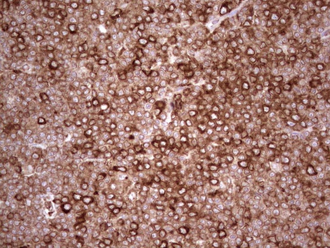 YBX1 Antibody in Immunohistochemistry (Paraffin) (IHC (P))