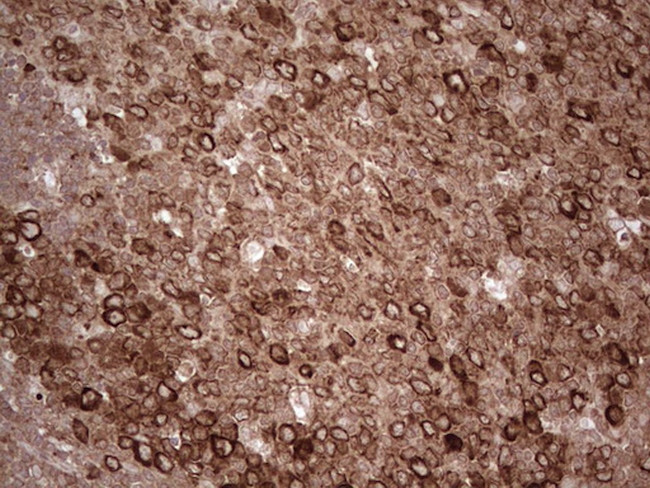 YBX1 Antibody in Immunohistochemistry (Paraffin) (IHC (P))