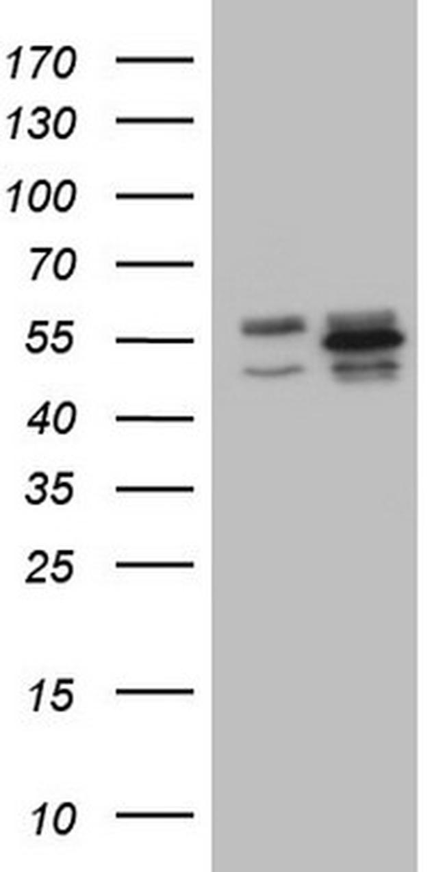 YBX1 Antibody in Western Blot (WB)