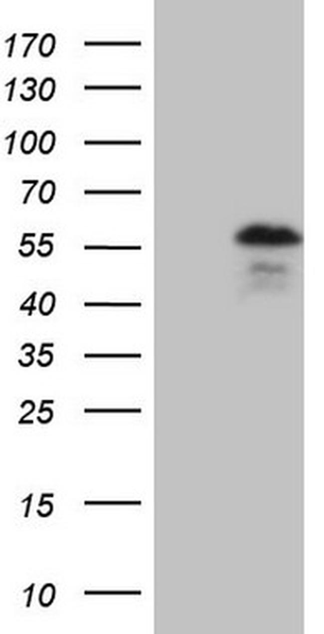 YBX1 Antibody in Western Blot (WB)