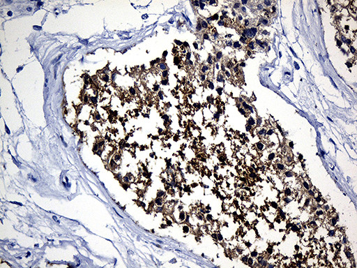 YBX2 Antibody in Immunohistochemistry (Paraffin) (IHC (P))