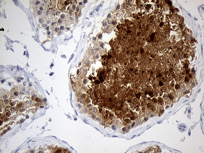 YBX2 Antibody in Immunohistochemistry (Paraffin) (IHC (P))