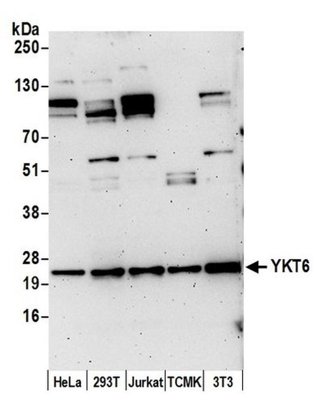 YKT6 Antibody in Western Blot (WB)