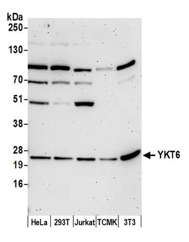 YKT6 Antibody in Western Blot (WB)