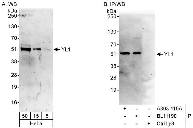 YL1 Antibody in Western Blot (WB)